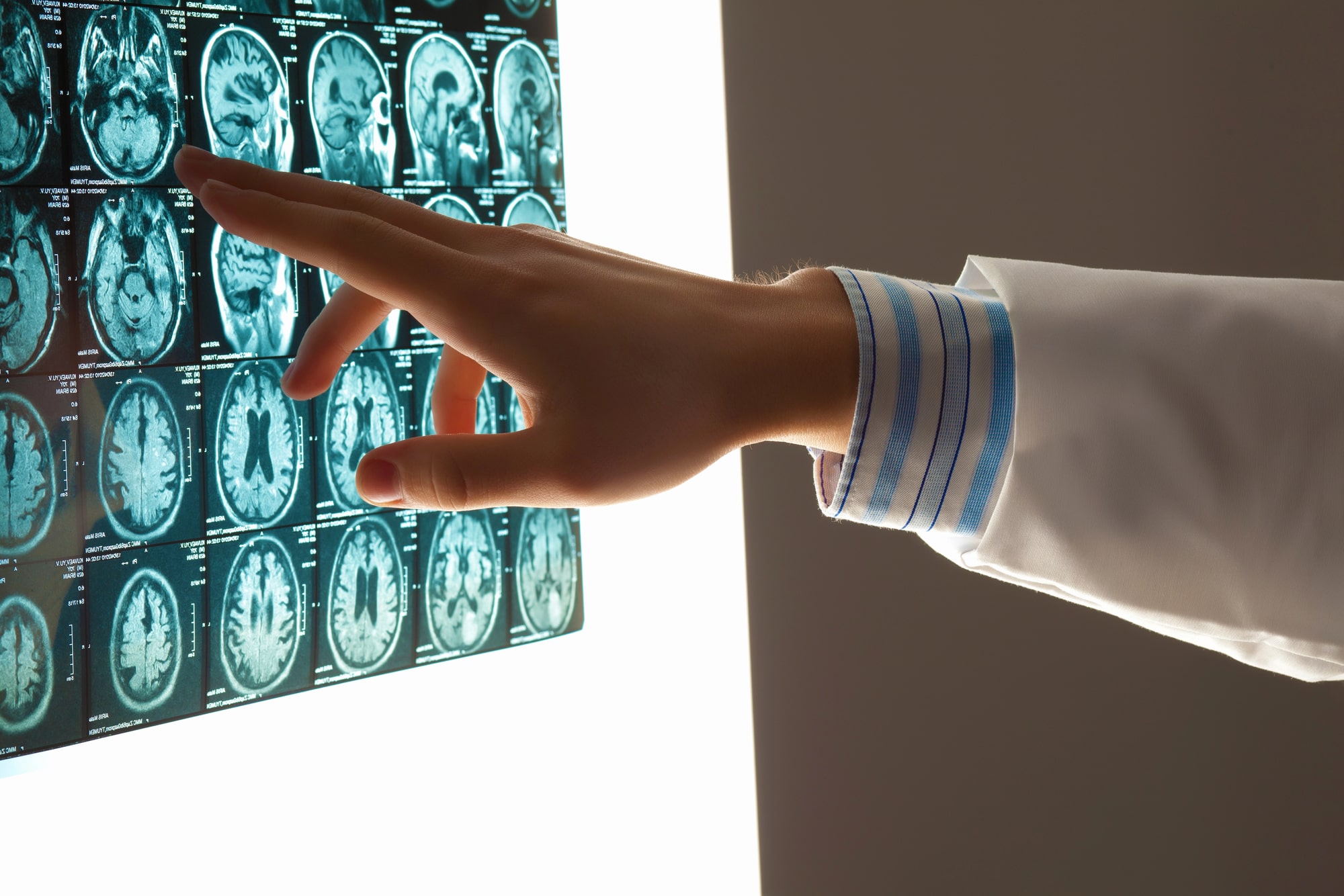 brain injury lawyer Lawrenceville, GA